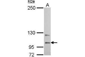 WB Image Autotaxin antibody detects ENPP2 protein by Western blot analysis.