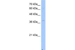 WB Suggested Anti-NSDHL Antibody Titration:  2. (NSDHL antibody  (Middle Region))