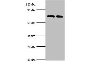 Western blot All lanes: DHX58 antibody at 12 μg/mL Lane 1: 293T whole cell lysate Lane 2: Rat kidney tissue Secondary Goat polyclonal to rabbit IgG at 1/10000 dilution Predicted band size: 77 kDa Observed band size: 77 kDa (DHX58 antibody  (AA 389-678))