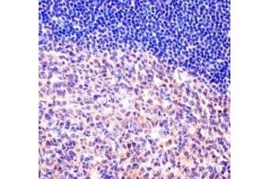 MCM6 antibody immunohistochemistry analysis in formalin fixed and paraffin embedded human tonsil tissue. (MCM6 antibody  (AA 80-109))