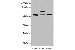 Western blot All lanes: ERO1L antibody at 2. (ERO1L antibody  (AA 24-260))