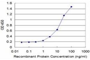 Detection limit for recombinant GST tagged CRLF1 is approximately 1ng/ml as a capture antibody. (CRLF1 antibody  (AA 135-230))