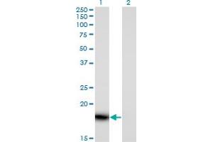 Western Blot analysis of PLA2G16 expression in transfected 293T cell line by PLA2G16 monoclonal antibody (M02), clone 4C4-2A11. (PLA2G16 antibody  (AA 1-162))