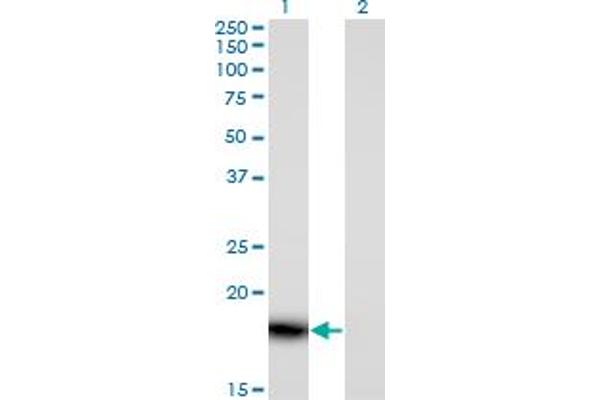 PLA2G16 抗体  (AA 1-162)