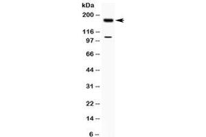 Western blot testing of human MCF7 cell lysate with TIAM1 antibody at 0.
