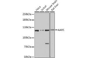 Western blot analysis of extracts of various cell lines, using AARS Rabbit pAb (ABIN7265526) at 1:3000 dilution. (AARS antibody  (AA 1-100))
