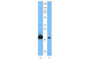 Western Blotting (WB) image for anti-Interleukin 21 (IL21) antibody (Biotin) (ABIN2666224) (IL-21 antibody  (Biotin))