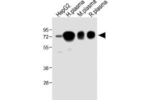 All lanes : Anti-HPX Antibody (Center) at 1:2000 dilution Lane 1: HepG2 whole cell lysate Lane 2: Human plasma lysate Lane 3: Mouse plasma lysate Lane 4: Rat plasma lysate Lysates/proteins at 20 μg per lane. (Hemopexin antibody  (AA 200-227))