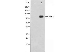 Western blot analysis on LOVO cell lysate using Cullin 2 Antibody,The lane on the left is treated with the antigen-specific peptide. (Cullin 2 antibody  (C-Term))