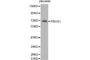 Western Blotting (WB) image for anti-Protein S (PROS) (AA 405-676) antibody (ABIN6218667) (PROS1 antibody  (AA 405-676))