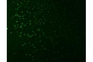 IF analysis of SNRNP27 using anti-SNRNP27 antibody (ABIN7599614). (SNRNP27 antibody  (AA 100-155))