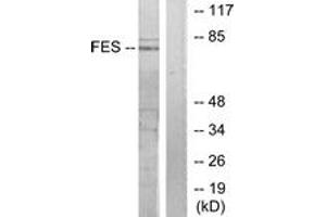 Western blot analysis of extracts from HuvEc cells, treated with serum 20% 30', using FES Antibody. (FES antibody  (AA 131-180))