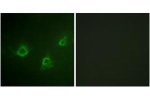 Immunofluorescence analysis of COS7 cells, using PLCG1 (Ab-1253) Antibody. (Phospholipase C gamma 1 antibody  (AA 1221-1270))
