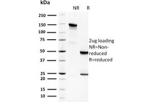 SDS-PAGE Analysis Purified Spermidine Monoclonal Antibody (CPTC-SAT1-3). (SAT1 antibody)