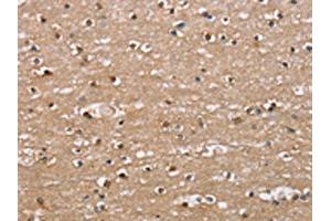 The image on the left is immunohistochemistry of paraffin-embedded Human brain tissue using ABIN7189673(ADGRB2 Antibody) at dilution 1/25, on the right is treated with synthetic peptide. (BAI2 antibody)