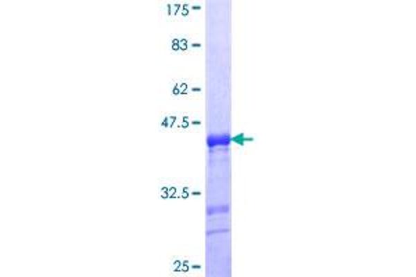 Enamelin Protein (ENAM) (AA 1043-1141) (GST tag)