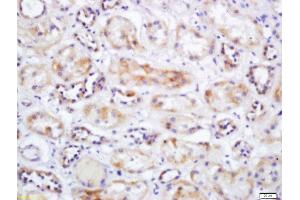 Formalin-fixed and paraffin embedded human kidney labeled with Rabbit Anti-SLC25A10 Polyclonal Antibody, Unconjugated  at 1:200 followed by conjugation to the secondary antibody and DAB staining (SLC25A10 antibody  (AA 201-287))