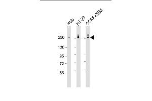 All lanes : Anti-POLR2A Antibody (monoclonal) (M01) at 1:2000 dilution Lane 1: Hela whole cell lysate Lane 2: HT-29 whole cell lysate Lane 3: CCRF-CEM whole cell lysate Lysates/proteins at 20 μg per lane. (POLR2A/RPB1 antibody  (AA 340-566))