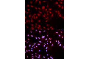Immunofluorescence (IF) image for anti-Met Proto-Oncogene (MET) (pTyr1349) antibody (ABIN1870436) (c-MET antibody  (pTyr1349))