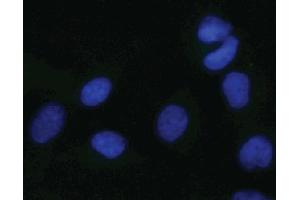Immunofluorescent staining of HeLa cells. (MAPK14 antibody  (pThr180))