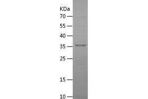 MPPED2 Protein (AA 1-294) (His tag)