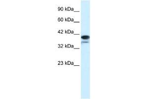 PARP6 antibody used at 1. (PARP6 antibody)