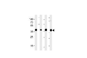 Western blot analysis of lysates from 293,RD,mouse NIH/3T3,rat L6 cell line (from left to right),using ALDOA Antibody (N-term) (ABIN389191 and ABIN2839354).