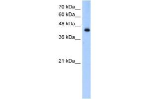 Transfected 293T; WB Suggested Anti-ACADL Antibody Titration: 0. (ACADL antibody  (N-Term))