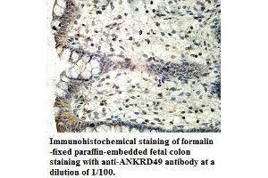 Image no. 1 for anti-Ankyrin Repeat Domain 49 (ANKRD49) antibody (ABIN1574707)