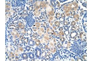 SLC38A1 antibody was used for immunohistochemistry at a concentration of 4-8 ug/ml to stain EpitheliaI cells of renal tubule (arrows) in Human Kidney. (SLC38A1 antibody  (Middle Region))
