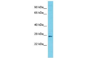 Host: Rabbit Target Name: C11orf70 Sample Type: Jurkat Whole Cell lysates Antibody Dilution: 1. (C11ORF70 antibody  (C-Term))