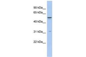 Image no. 1 for anti-Tripartite Motif Containing 14 (TRIM14) (AA 215-264) antibody (ABIN6742515) (TRIM14 antibody  (AA 215-264))