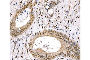 IHC analysis of CRTC3 using anti-CRTC3 antibody (ABIN7599779). (CRTC3 antibody  (AA 116-619))