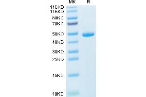 Mouse IL-20 on Tris-Bis PAGE under reduced condition. (IL-20 Protein (AA 25-176) (Fc Tag))