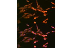 Immunofluorescence analysis of NIH-3T3 cells using DISC1 Rabbit mAb (ABIN7266799) at dilution of 1:100 (40x lens). (DISC1 antibody)
