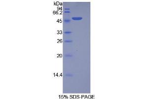 SDS-PAGE analysis of Human Integrin alpha 5 Protein.