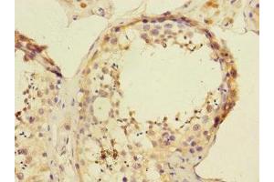 Immunohistochemistry of paraffin-embedded human testis tissue using ABIN7144788 at dilution of 1:100 (Ataxin 1 antibody  (AA 346-475))