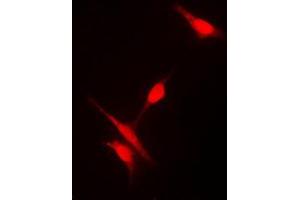 Immunofluorescent analysis of Histone Deacetylase 10 staining in Jurkat cells. (HDAC10 antibody  (N-Term))