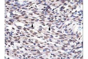 Image no. 1 for anti-Growth Factor Independent 1B Transcription Repressor (GFI1B) (N-Term) antibody (ABIN6735866) (GFI1B antibody  (N-Term))