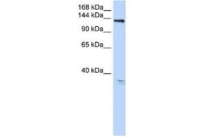 WB Suggested Anti-TMEM16C Antibody Titration:  0. (ANO3 antibody  (C-Term))