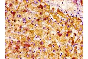 IHC image of ABIN7161191 diluted at 1:400 and staining in paraffin-embedded human liver tissue performed on a Leica BondTM system. (Netrin 1 antibody  (AA 186-478))