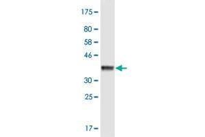 Western Blot detection against Immunogen (36. (KIF3B antibody  (AA 648-747))