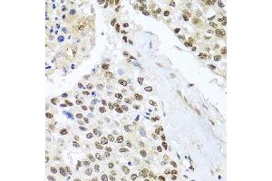 Immunohistochemistry (IHC) image for anti-BCL2/adenovirus E1B 19kDa Interacting Protein 3-Like (BNIP3L) antibody (ABIN1980299)