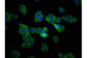 Immunofluorescence staining of HepG2 cells with ABIN7171895 at 1:233, counter-stained with DAPI. (Tetraspanin 9 antibody  (AA 107-203))
