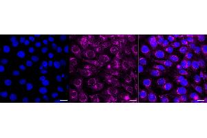 Immunocytochemical staining of HT- cells with Amyloid beta precursor protein antibody (ABIN7797593), 1:1,000). (Recombinant APP antibody)