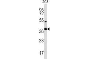 Western blot analysis in 293 cell line lysates (35ug/lane) using NKX2-2  Antibody . (Nkx2-2 antibody  (Middle Region))