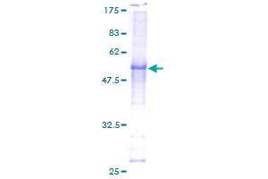 Image no. 1 for Cyclin C (CCNC) (AA 1-283) protein (GST tag) (ABIN1348443) (Cyclin C Protein (CCNC) (AA 1-283) (GST tag))