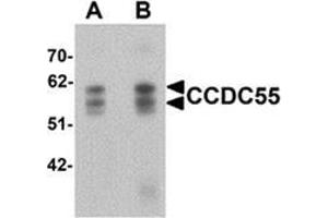 Western blot analysis of CCDC55 in human brain tissue lysate with CCDC55 antibody at (A) 0. (NSRP1 antibody  (C-Term))