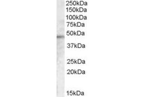 ABIN238616 (0. (TMPRSS3 antibody  (Internal Region))