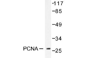 Image no. 1 for anti-Proliferating Cell Nuclear Antigen (PCNA) antibody (ABIN271780) (PCNA antibody)